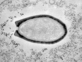 Biggest Virus Yet Found, May Be Fourth Domain of Life?