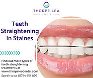 Teeth Straightening Staines