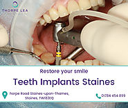 Teeth Implants Staines