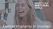 Dental Implants Staines