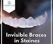 Invisible Braces Staines