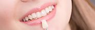 What can an individual expect from Porcelain veneers Melbourne professionals?