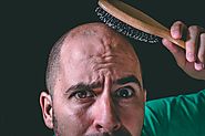 When Will There Ever Be a Cure for Baldness? - Nanalyze