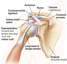 Cost Effectual Shoulder Replacement Surgery India
