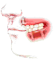 Dental Implants - ETOMS
