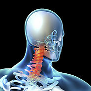Cervical Disc Replacement and Missouri Workers’ Compensation