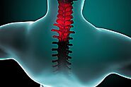 Stiff Neck Causes and Treatments | Arizona Pain and Spine Institute