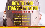 How to Hair Transplantation Evolved in Years | Blog Care Well Medical Centre