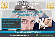 Do 5 stars Clinics Deliver the Best Results of Hair Transplant? | Blog Care Well Medical Centre