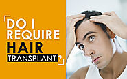 Do I require Hair Transplant?