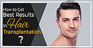 How to Get Best Results In Hair Transplantation?