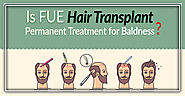 Is FUE Hair Transplant Permanent Treatment for Baldness?