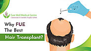 Why FUE is Considered the Best Hair Transplant?