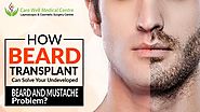 How Beard Transplant Can Solve Your Undeveloped Beard and Mustache Problem?