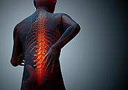 Back Pain After Car Accident & Back Injury From Car Accident