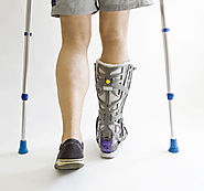 Leg Injuries from Car Accidents