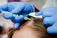 Mesotherapy For Hair Growth – Does It Work? - Laser Skin Care