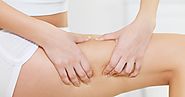 Mesotherapy for cellulite - Does it Works?