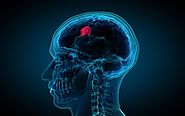 Know the types of brain Tumor and Its Treatments