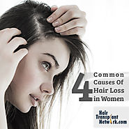 4 Common Causes Of Hair Loss in Women
