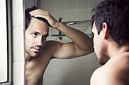 How to Treat the Common Causes of Male Hair Loss