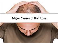 Major Causes of Hair Loss