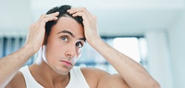 Hair Loss Myths and Treatments