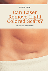 Can Laser Remove Light Colored Scars? - Laser Skin Care