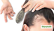 Best Home Remedies to Prevent Hair Loss in Women | Home Remedies for Hair