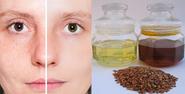 Many Treatments For Pimples And Economical, Safe and effective Natural Programs Intended for Pimple