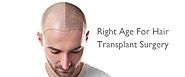 What's The Perfect Age/Time To Have A Hair Transplant