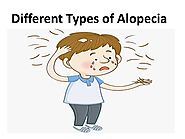 Different Types of Alopecia