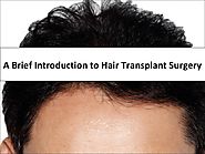 A Brief Introduction to Hair Transplant Surgery
