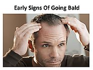 Early Signs Of Going Bald