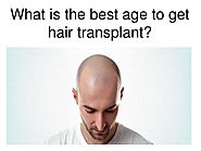 What is the best age to get hair transplant?