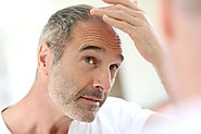 Stop Hair Loss Naturally! Fact or Fiction?