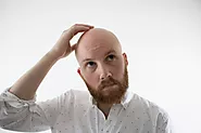 Deciding Between Shaving Your Head or A Hair Transplant READ THIS!