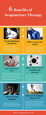 Benefits of Acupuncture Therapy