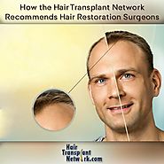 How the Hair Transplant Network Recommends Hair Restoration Surgeons