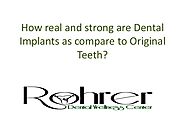 How Real And Strong Are Dental Implants As Compare To Original Teeth?