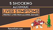 5 Shocking Alcoholic Liver Disease Symptoms (Take Action Now)