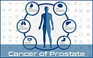 Prostate Cancer Drugs, Prostate Cancer Medications | Hetero Healthcare