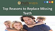 Top Reasons to Replace Missing Teeth