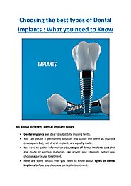 Everything You Need to Know While Choosing the Best types of Dental Implants