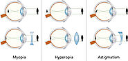 Êtes vous hypermétrope ou astigmate ?