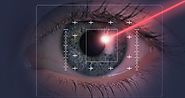 Chirurgie des yeux : les progrès du laser | Santé Magazine