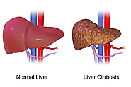 All About Liver Test At Home One Should Know - Self Diagnostics