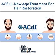 ACELL — New Age Treatment For Hair Restoration – Hair Transplant Network – Medium