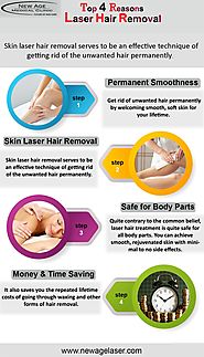 Top 4 Reasons to Choose Laser Hair Removal