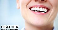 Keep your Teeth Bright After Teeth Whitening